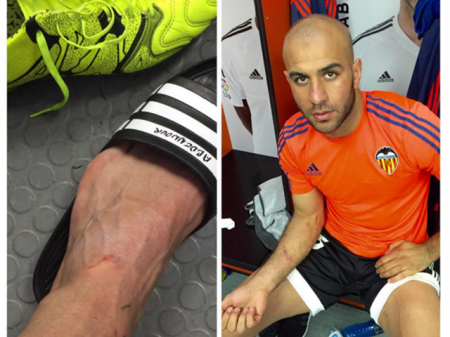 عبد النور يُوثّق  بصمة  سواريز عليه بالصور