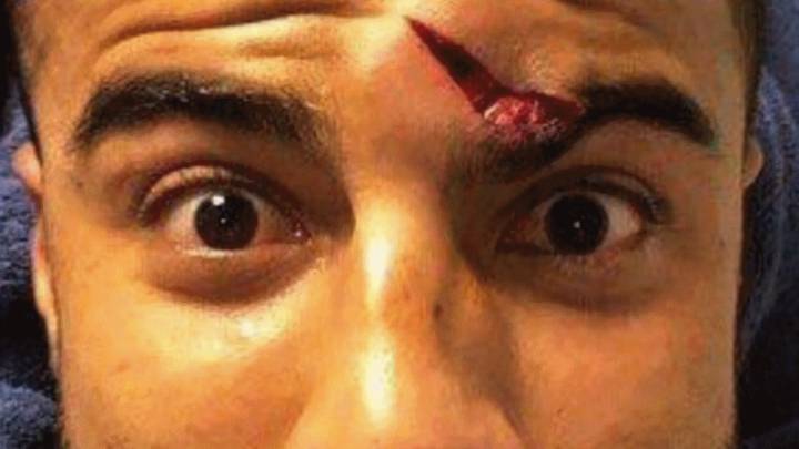 برشلونة يعلن اصابة البرازيلي رافينيا