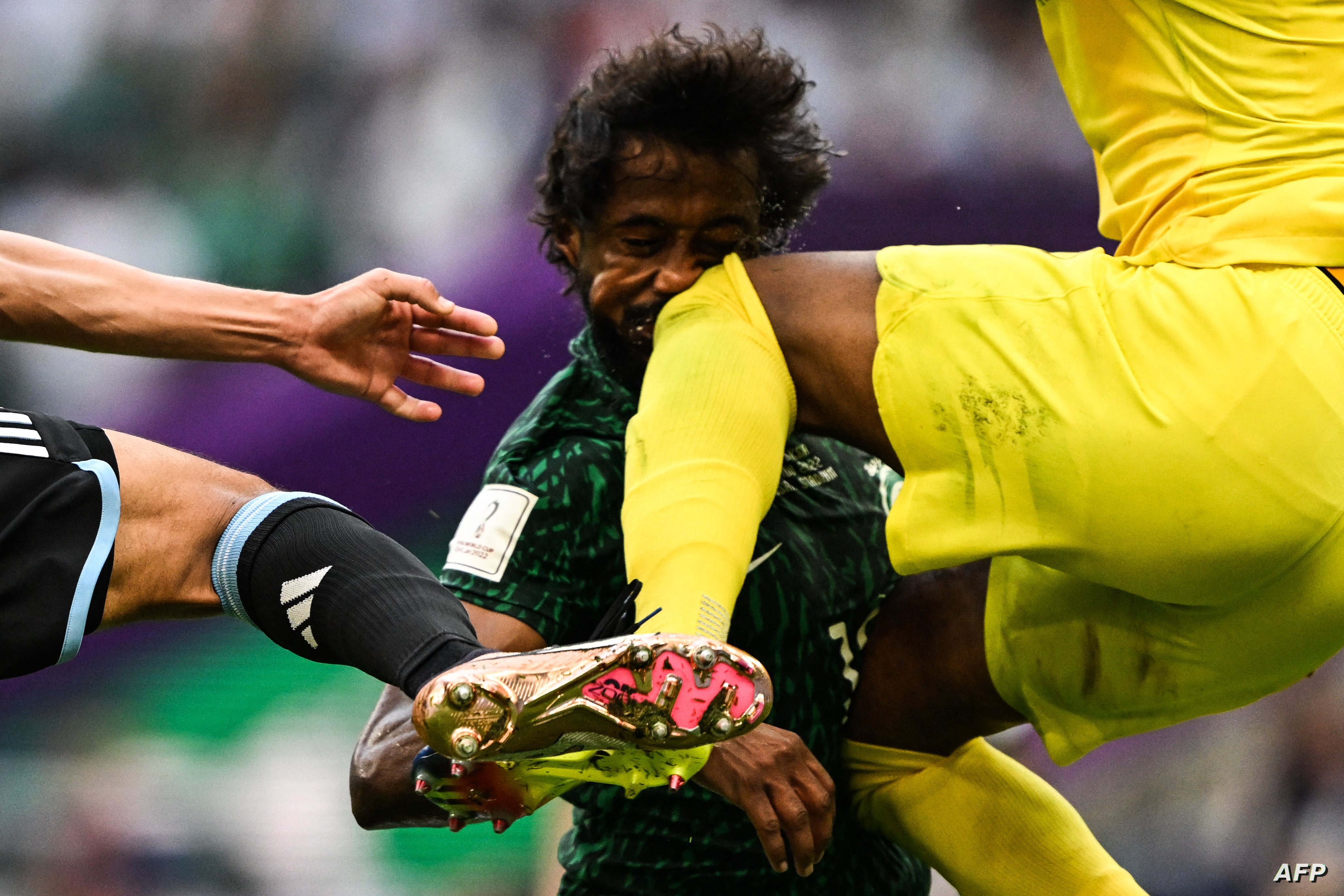 مونديال 2022: السعودي الشهراني سيخضع لجراحة في الرياض