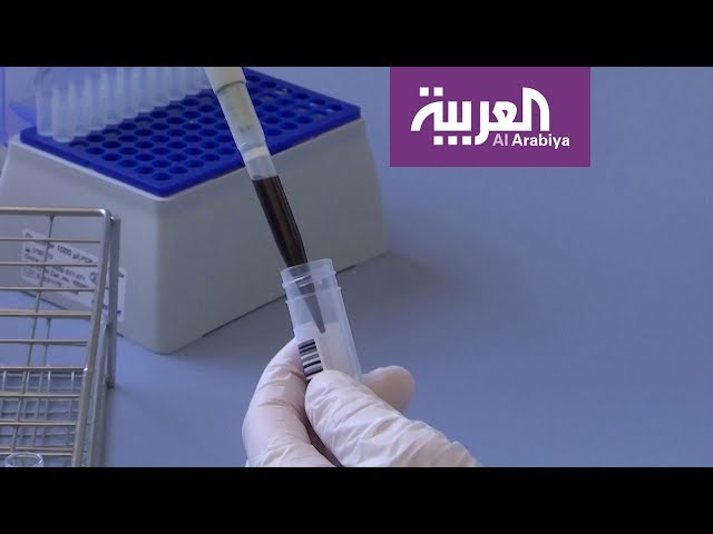 تطورات رائعة لعلاج فيروس كورونا ببلازما الدم