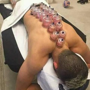 بعد حارث .. عميد الأسود ينصح سايس بالحجامة