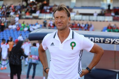 هل أصيب رونار في الرأس؟