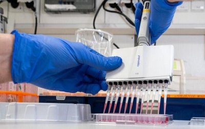 علماء يطورون تقنية اختبار سريع لڤيروس كورونا