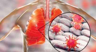 الصين تكشف مدة بقاء ڤيروس كورونا نشطا ودرجة الحرارة التي ينتعش فيها