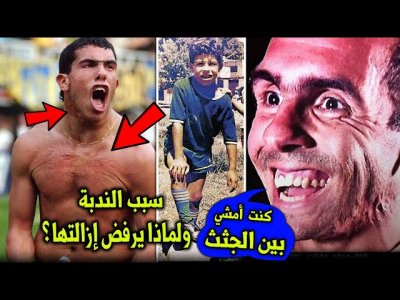 كارلوس تيفيز | تخلى عنه والداه ونشأ في أسوء أحياء الأرجنتين