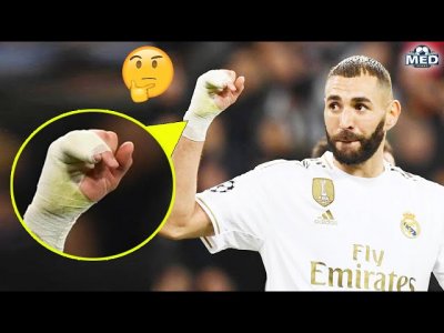 لماذا يضع كريم بنزيمة ضمادة على يده اليمنى في جميع المباريات ؟؟